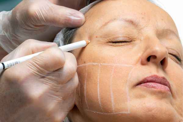 CryoPen: 5 Skin Concerns It May Be Used to Treat 4 What should you ask before having CryoPen treatment ?